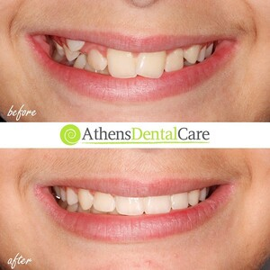 Athens Dental Care _0