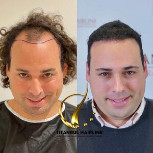 Istanbul Hairline _1