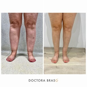 Doctora Brasó _3