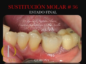 Seville Oral Implantology Center _1