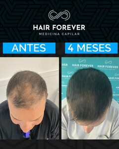 Hair Forever _2