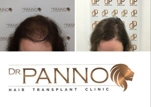 Dr. Panno Hair Clinic _0