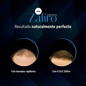 Medical Hair Spain _0