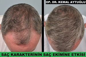 Aytuğlu Hairtrans _1