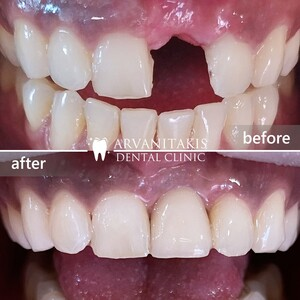 Arvanitakis Dental Clinic _3