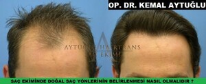 Aytuğlu Hairtrans _0