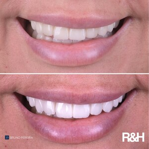 R&H Dental Marbella _2