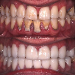 Cure Dents Dental Clinic _0