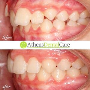 Athens Dental Care _2