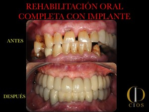 Seville Oral Implantology Center _3