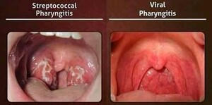 Department of Otorhinolaryngology _2