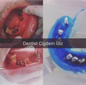 Çiğdem İdiz _2