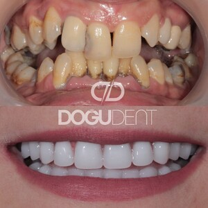 DoğuDent Dental Clinic _2