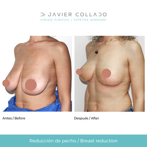 Javier Collado _3