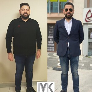 MYK Clinic - Dr. Metin Yüksel Kerimoğlu _2