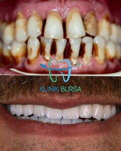 Klinik Bursa _3