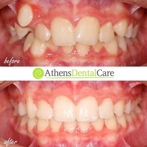 Athens Dental Care _3