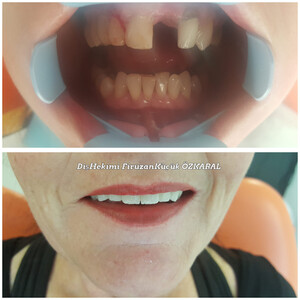 Konyaaltı Dental Clinic _3