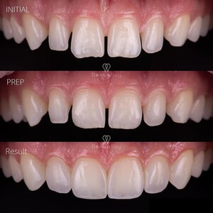 DentaRay Clinic _2