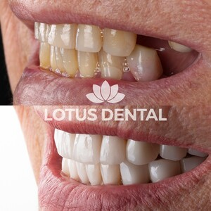 Lotus Dental Clinic _0