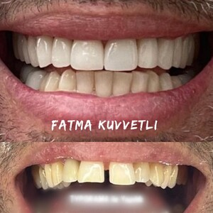 Fatma Kuvvetli _2