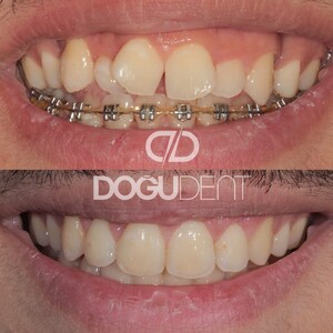 DoğuDent Dental Clinic _3