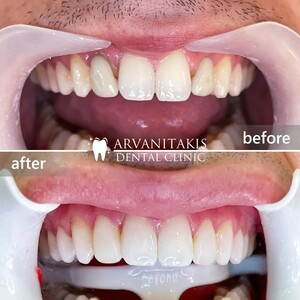 Arvanitakis Dental Clinic _1