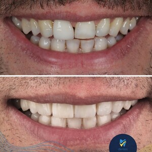 Dentes Dental Clinic _3