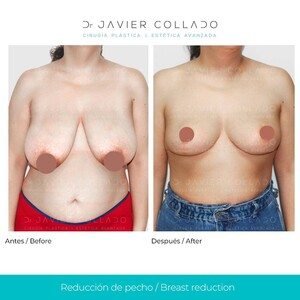 Javier Collado _0