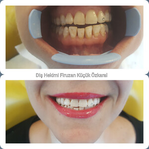 Konyaaltı Dental Clinic _0