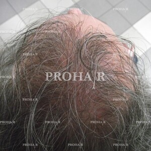 Prohair Clinic _3