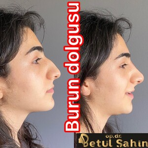 Betül Şahin _1