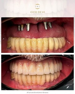 Golden Dental Aesthetic _1