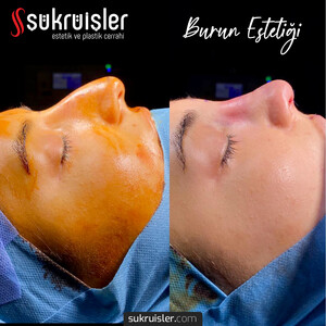 Dr şükrü İşler Clinic _3