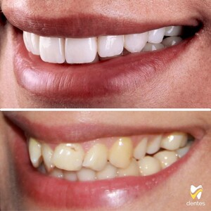 Dentes Dental Clinic _1