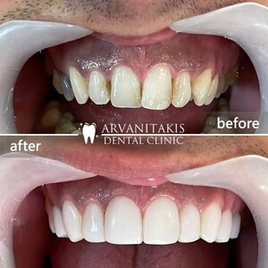 Arvanitakis Dental Clinic _2