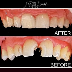 Elif Dental Clinic _0