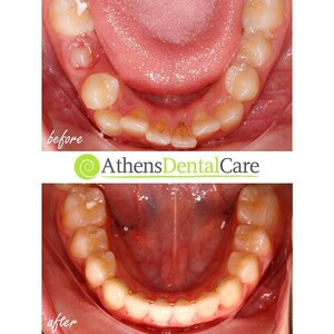 Athens Dental Care _1