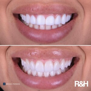 R&H Dental Marbella _1