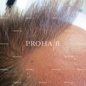 Prohair Clinic _2