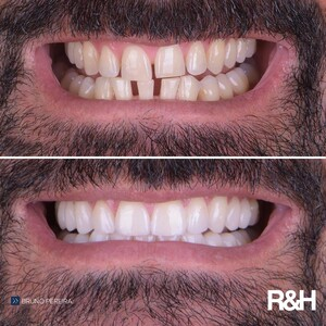 R&H Dental Marbella _0