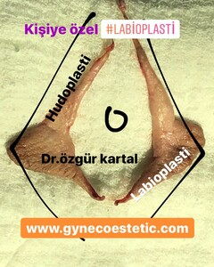 Özgür Kartal _1