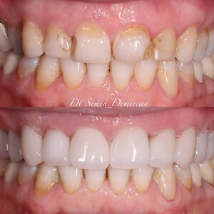 Cure Dents Dental Clinic _2