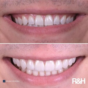 R&H Dental Marbella _3