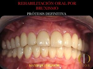 Seville Oral Implantology Center _2