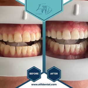 Elif Dental Clinic _3