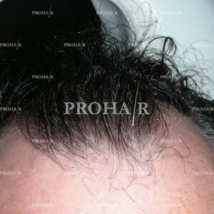 Prohair Clinic _0