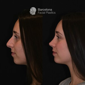 Barcelona Facial Plastics _0