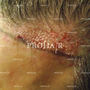 Prohair Clinic _1