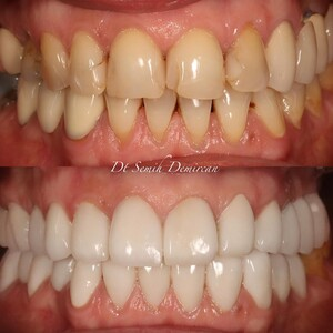 Cure Dents Dental Clinic _3